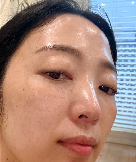팩하기전 기미잡티보이는 사진