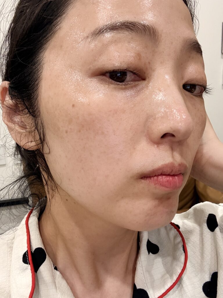 10년째 비타민C 사용하는 예민피부